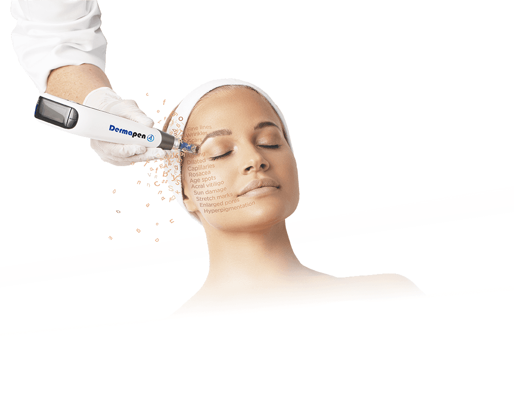 Microneedling treatment at Aever Clinics