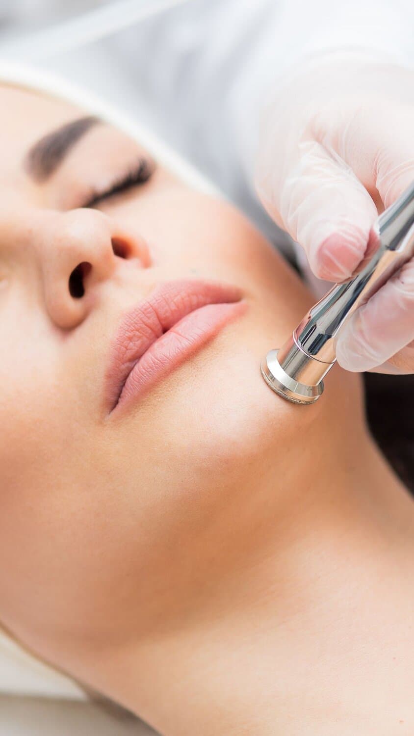 Microdermabrasion Aever Clinics Rotterdam