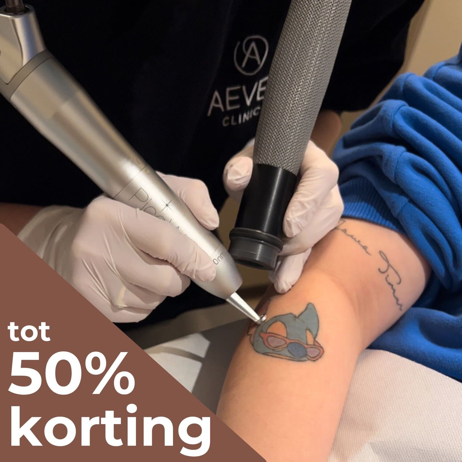 Laser tatoeage verwijdering vervaagt en verwijdert ongewenste tatoeages