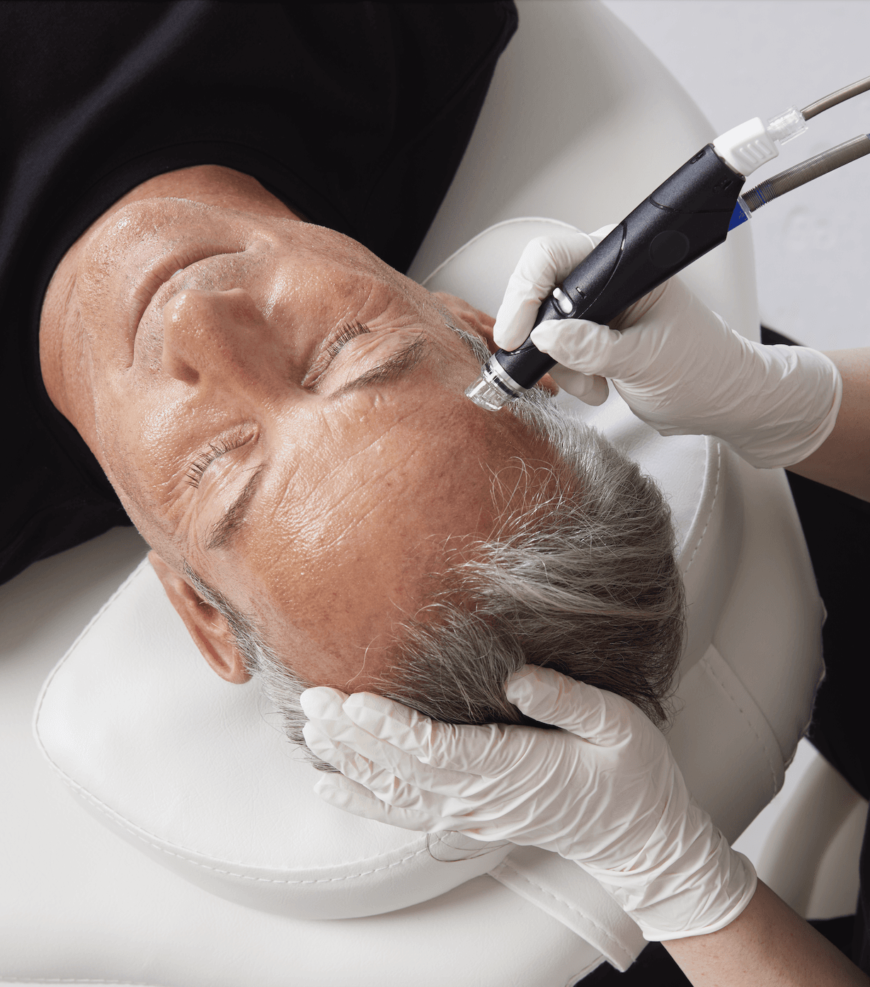 Hydrafacial treatment reviews