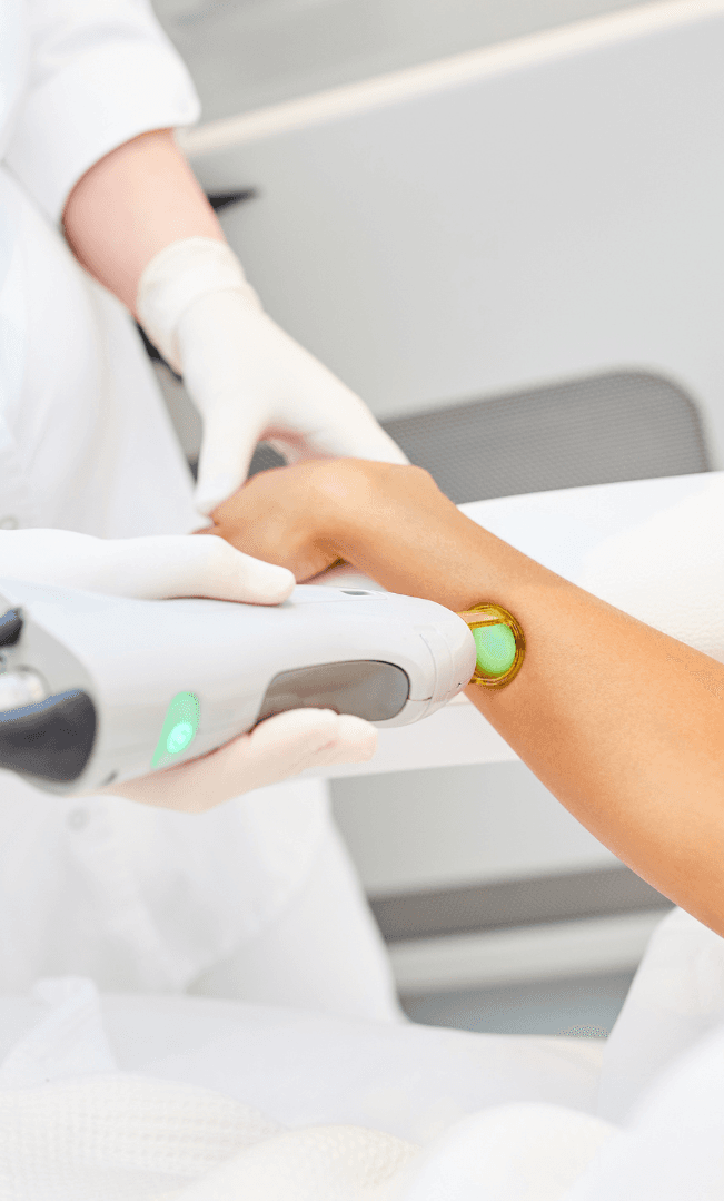 Laser Hair Removal in Utrecht