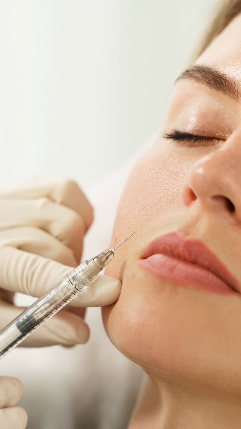 Dermal filler Aever Clinics Den Haag