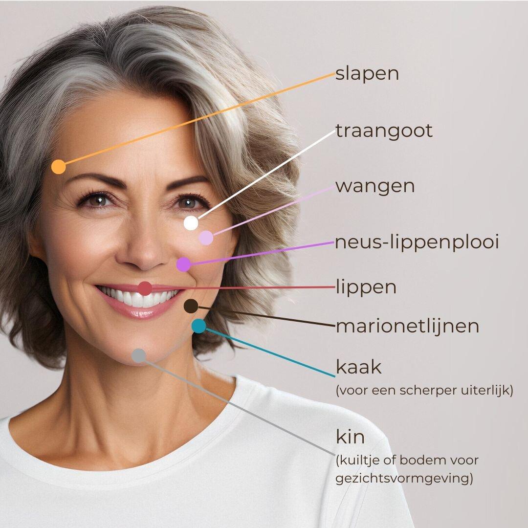 treatment areas of dermal filler