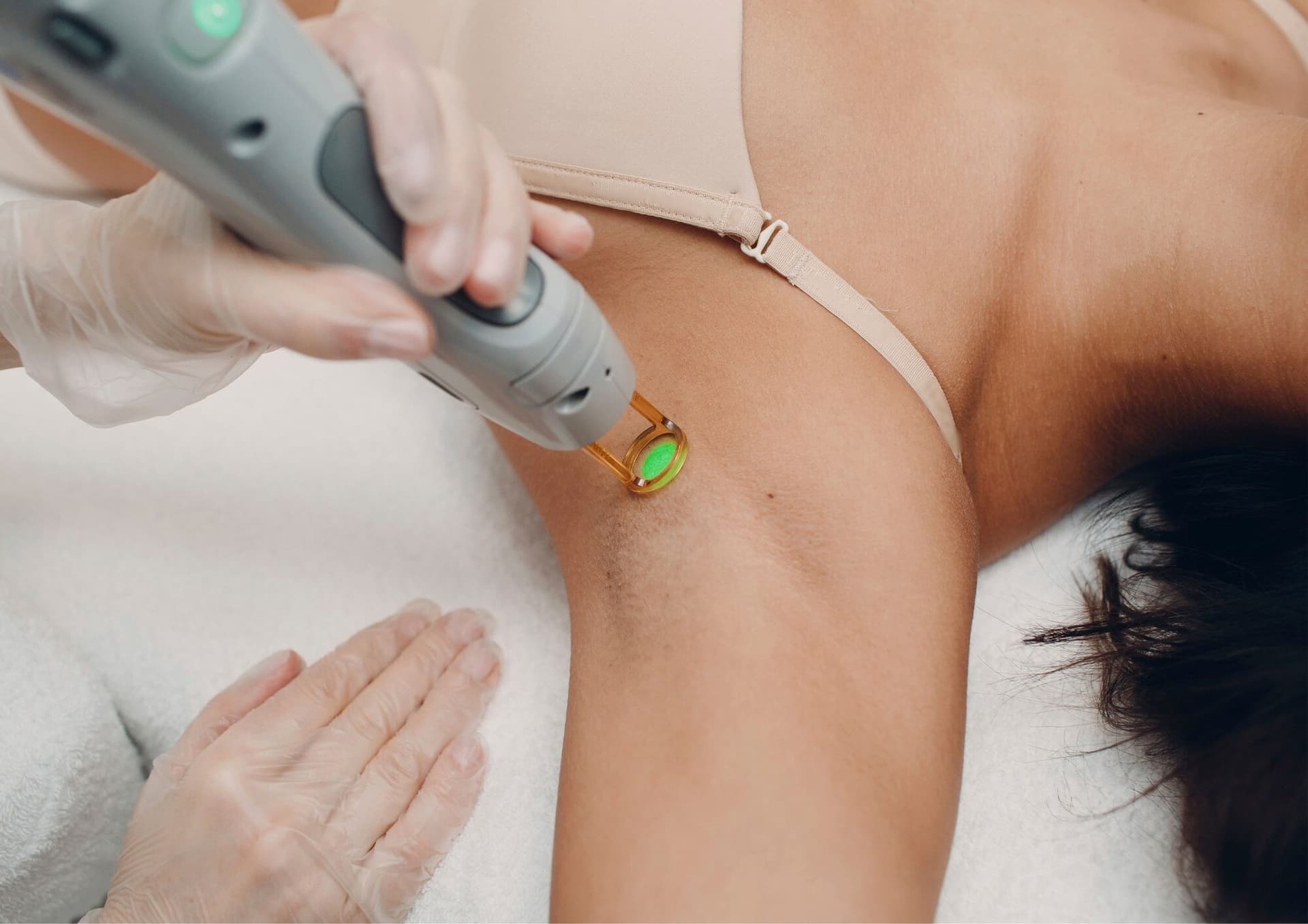 Laser Hair Removal at Aever Clinics