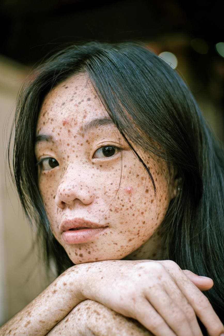 Pigmentation symptoms