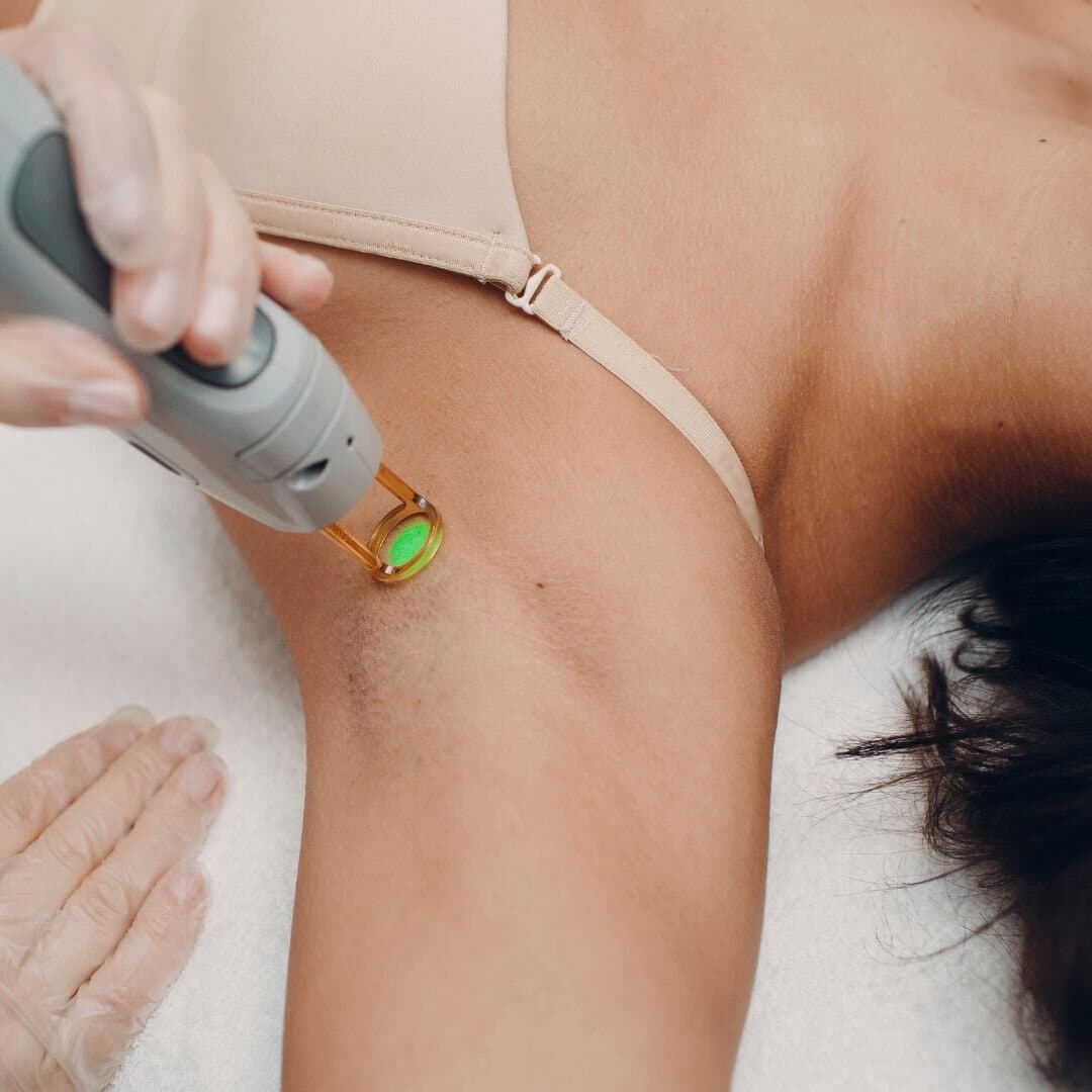 Laser hair removal with a skin therapist