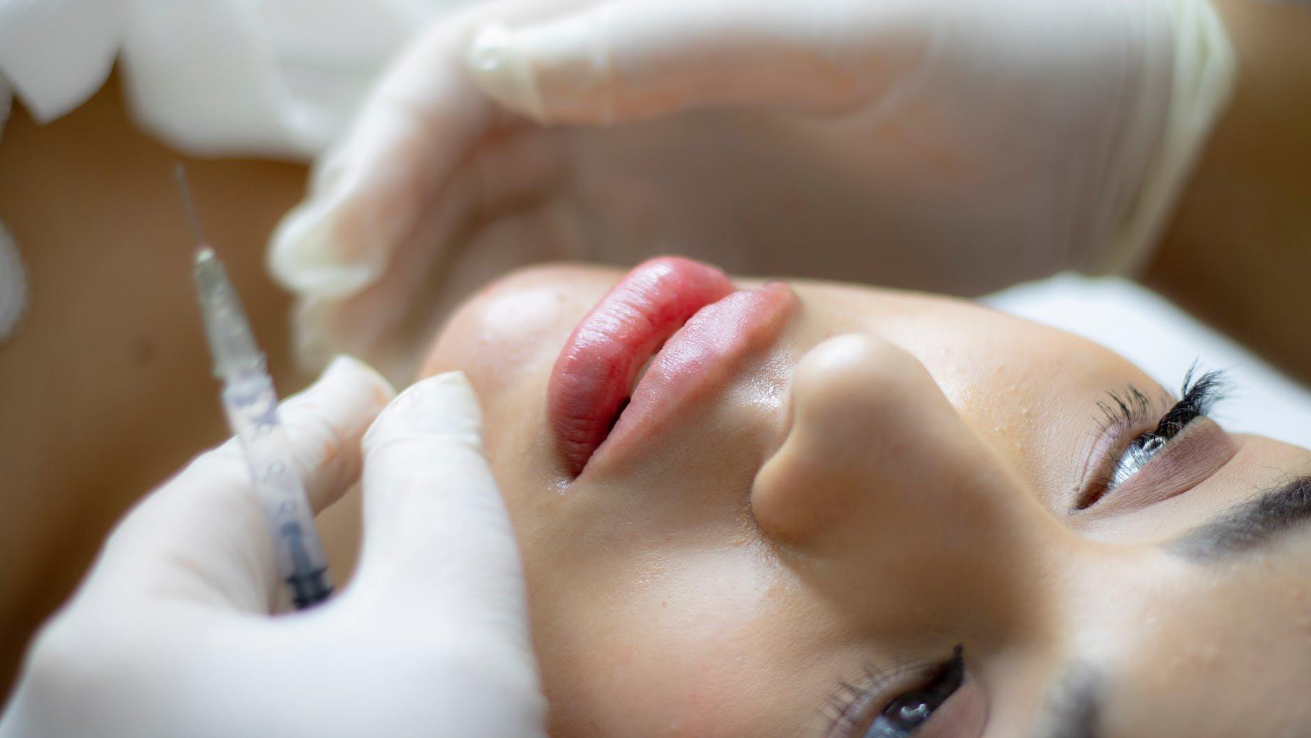 The benefits of lip filler - Aever Clinics