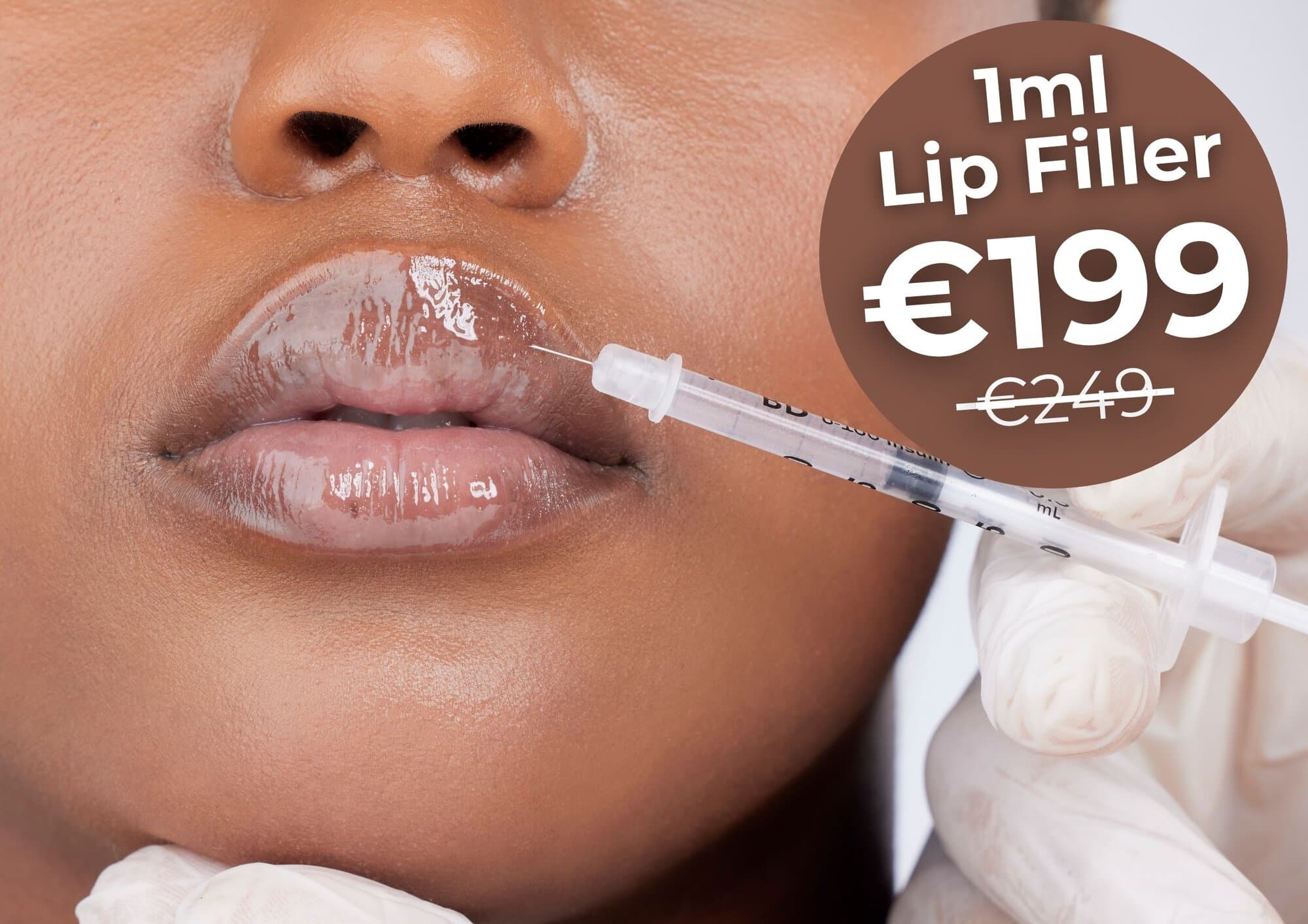 lip filler sale Aever Clinics